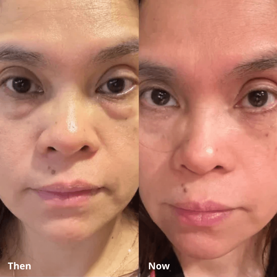 Calcium Multi Balm KAHI - Anti-Wrinkle Formula