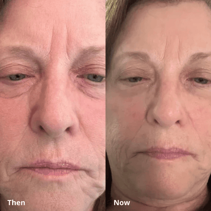 Calcium Multi Balm KAHI - Anti-Wrinkle Formula